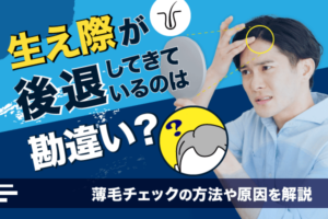 生え際が後退してきているのは勘違い？薄毛チェックの方法や原因を解説