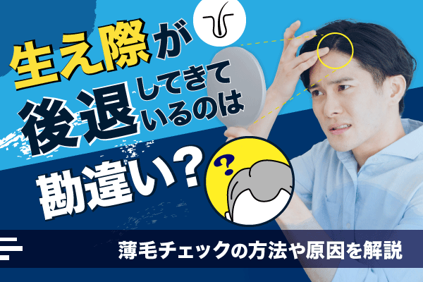 【小森公開準備】生え際が後退してきているのは勘違い？薄毛チェックの方法や原因を解説