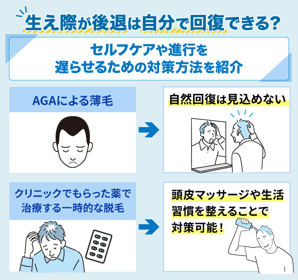 生え際後退は自然回復しない！遅らせるための対策方法を紹介した図