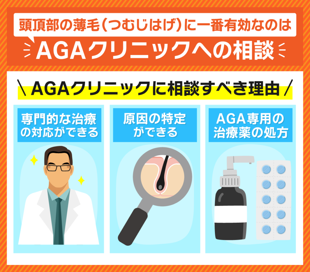 頭頂部薄毛（つむじはげ）の治療に一番有効なのはAGAクリニックに相談すること