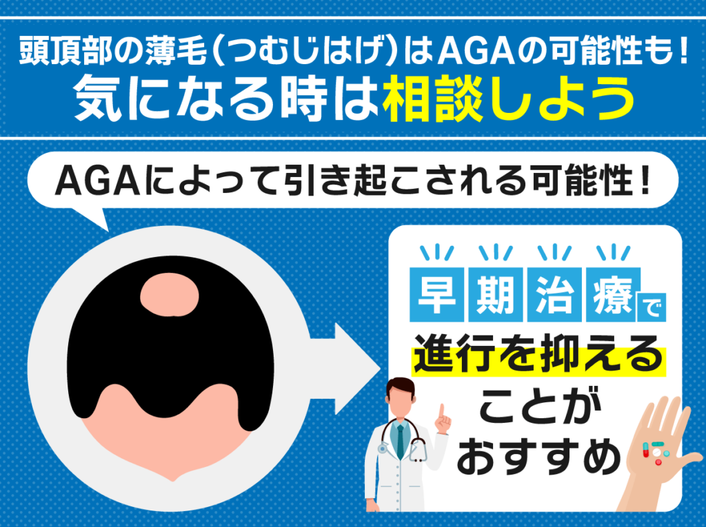 頭頂部薄毛（つむじはげ）はAGAの可能性がある！気になる場合は相談しよう