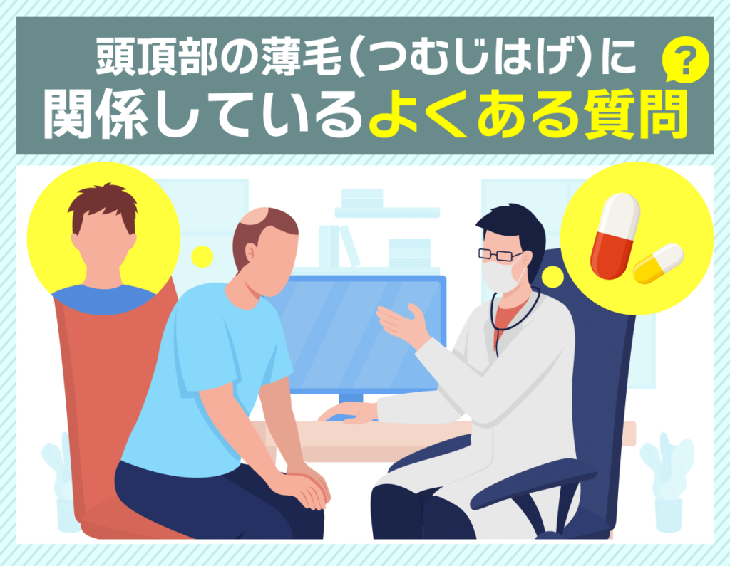 頭頂部薄毛（つむじはげ）に関するよくある質問