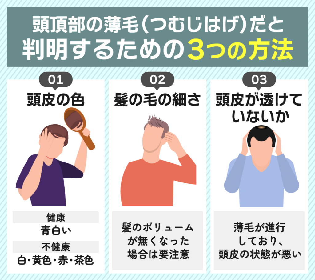 頭頂部薄毛（つむじはげ）と判断する3つの方法