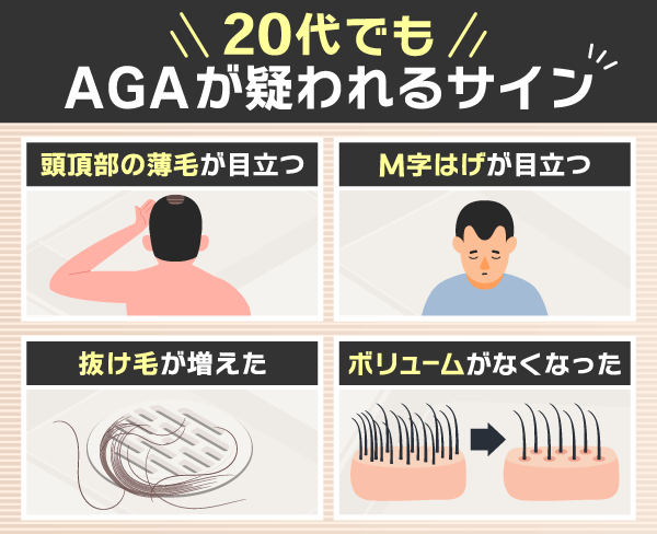 20代でもAGAが疑われる初期症状やサイン4選