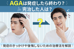 AGAは発症したら終わり？完治した人は？発症のきっかけや後悔しないための治療法を解説