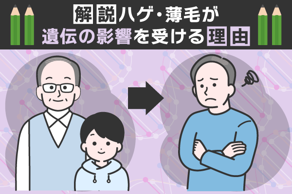 ハゲ・薄毛が遺伝の影響を受ける理由について解説