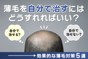 ハゲ・薄毛は遺伝が原因？AGAの発症リスクや対策を解説