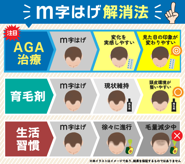 M字はげの治し方を方法別に紹介した表